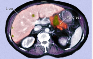 pancreas