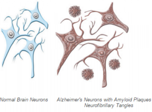 neuroni